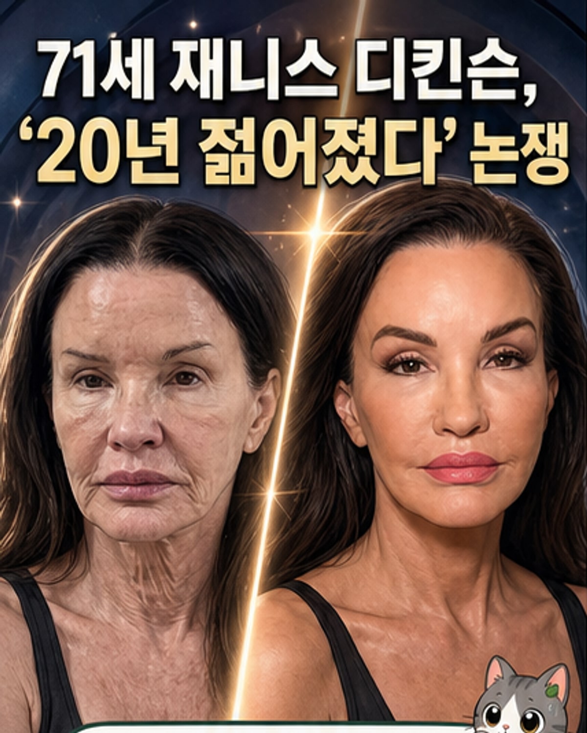 71세 모델, 시술로 20년 젊어진 얼굴