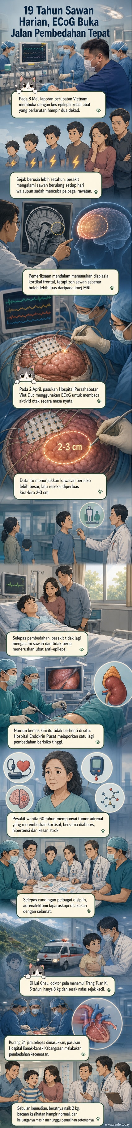Ilustrasi doktor melakukan pembedahan otak menggunakan teknologi ECoG untuk pesakit epilepsi kebal ubat.
